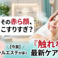 頬の赤みに悩む女性のイラストと、今泉のエステサロンでミストによる「触れない」最新フェイシャルケアを受けて潤いのある肌を手に入れた女性の比較画像。