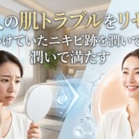 鏡の前で治りにくいニキビ跡に悩む女性と、たっぷりの潤いで満たされた美しい素肌になり笑顔を見せる女性のビフォーアフター画像。福岡で大人の肌トラブルをリセットするエステの魅力を伝えるアイキャッチ。
