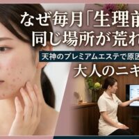 手鏡を見ながら頬やあごの肌荒れに悩む女性と、天神の完全個室でプロのカウンセラーに専門的なニキビ相談をして原因を突き止める様子の写真。生理前に繰り返すトラブルを解決するエステのイメージ。